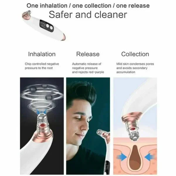 Glamzy Collection® Electric Blackhead Remover Facial Cleansing Pore Vacuum
